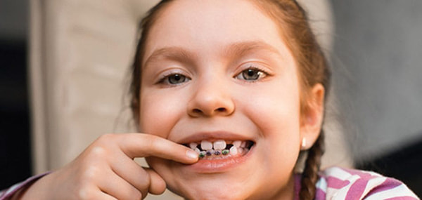 Chỉnh hình răng miệng có tác dụng gì?
