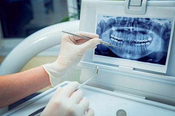 Khi nào cần đi khám và điều trị chỉnh hình răng?