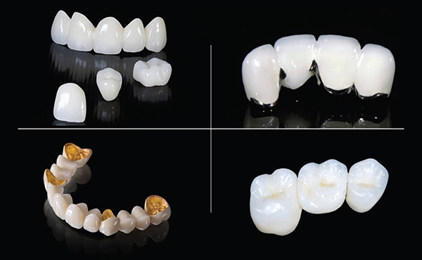 Vật liệu răng sứ mà bạn lựa chọn