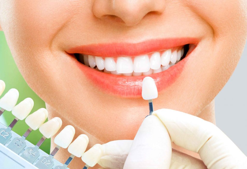 Tại sao nên chọn Nha khoa Đông Á để làm răng sứ?