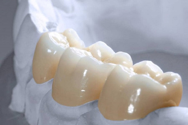 Răng sứ zirconia răng sứ giá tốt nhất dòng răng toàn sứ