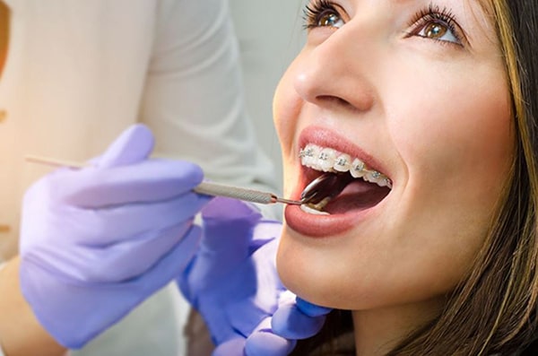 Nhổ răng khi niềng răng có ảnh hưởng gì đến sức khỏe không?