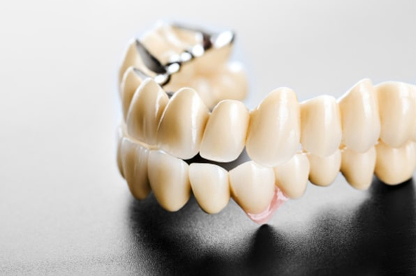 Tình trạng răng và phương pháp bạn lựa chọn