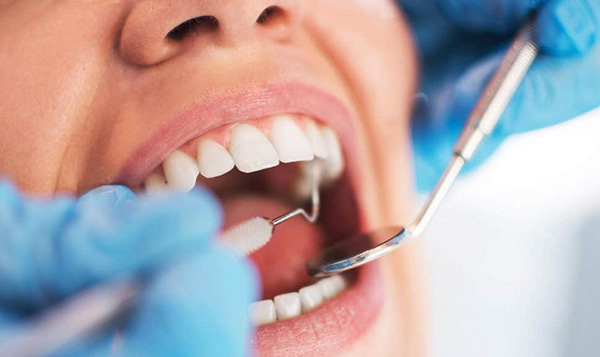 Bọc răng sứ sau khi lấy tủy có đau không?